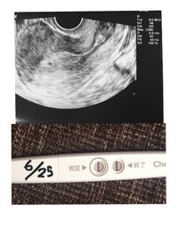 妊娠初期の出血 不安で不安で仕方ありません 5 31に仲良しし 6 Yahoo 知恵袋