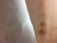 小さい頃から背骨が出ていてよっぽど背筋をピンとしていないと背骨が出ます そのせ Yahoo 知恵袋