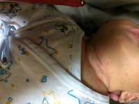 生後２ヶ月の赤ちゃんの首が画像のようになってました 昨日から何か臭いな Yahoo 知恵袋