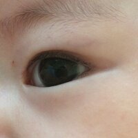 赤ちゃんの左右目の大きさについて今2ヶ月半の男の子を育てています 生後1ヶ Yahoo 知恵袋