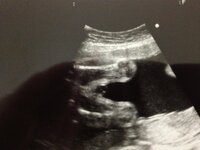 エコー写真の性別について 妊娠27週目です 先生に性別を聞いたら Yahoo 知恵袋