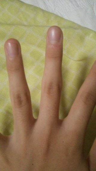 私は最近女子なのに 男性の指のようにゴツゴツしています でも 指をならす私 Yahoo 知恵袋
