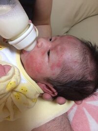 赤ちゃんが顔をこすります 4ヶ月になったばかりの赤ちゃんがいます 3ヶ月 Yahoo 知恵袋