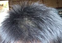 髪の毛についてですが 写真のやつで 太陽の日に当たると頭皮が見え Yahoo 知恵袋