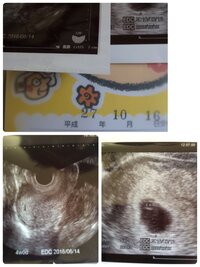 4w0d胎嚢確認5w2d心拍確認で母子手帳交付はそんなにも信じてもらえない速さ Yahoo 知恵袋
