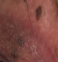 27歳女です 陰部にシミが出来たことに気づきました 以前は無く ここ最近できた Yahoo 知恵袋