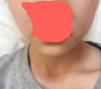 湘南美容クリニックでbnls注射を打とうと考えています モニターで4 Yahoo 知恵袋