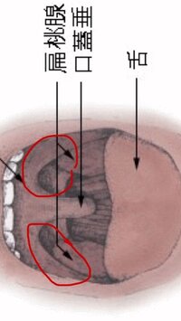 喉の腫れについて 喉が腫れており 唾や飲み物 食事を飲み込む時に辛いです 扁桃 Yahoo 知恵袋