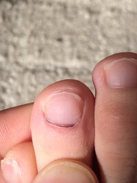 爪の生え際に黒い横線最近気づいたのですが 左足の薬指の爪の生え際に黒 Yahoo 知恵袋