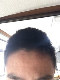 今坊主から髪の毛が生えてこんな感じでもさっとなっています 自分は坊 Yahoo 知恵袋