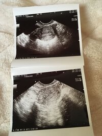 胎嚢確認前の妊娠2ヶ月妊婦です 一昨日 茶色いおりものがティッ Yahoo 知恵袋