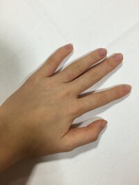 中１です 肌の色が黄色いです 小学生の時はみんなと同じ普通の色でした Yahoo 知恵袋