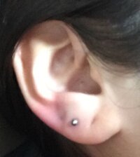 ピアスを開けて半年経っても安定しないのは遅すぎですか 半年前にロブに Yahoo 知恵袋