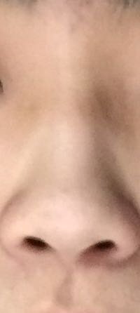 鼻の形変じゃないですか 正面から見て鼻の穴が丸見えなので少し気 Yahoo 知恵袋