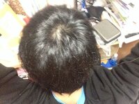 すみません 最近髪の毛が薄くなって来たのではないかと感じるようになりました Yahoo 知恵袋