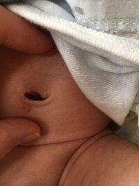 赤ちゃんのおへそが黒いのについて生後３ヶ月の赤ちゃんのおヘソが黒いで Yahoo 知恵袋