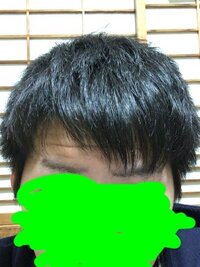 髪の毛について質問です 私は19歳の男です 私は 他の人よりも なぜか前 Yahoo 知恵袋