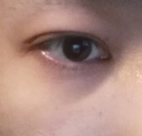 私はハーフなのですが よく目の下クマすごいねって言われます でもハーフは Yahoo 知恵袋