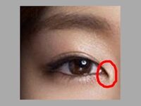 目頭切開ラインが 目やにになったり 丸く滲んだりしてすぐ駄目になってしまいま Yahoo 知恵袋