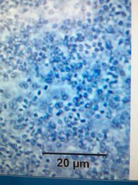 高校の生物の課題研究で菌や細菌を扱っています 大根おろしと植物培地 Ms を混 Yahoo 知恵袋