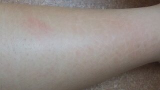 内なる 好奇心盛 染料 すね が カサカサ Toyoshin Biz