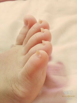 コンプリート 赤ちゃん 反り爪 赤ちゃんの画像は無料