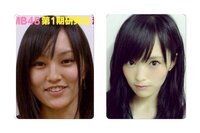 Akb Nmb48山本彩は完全に整形していると思うのですがそう思うのは私だけで Yahoo 知恵袋