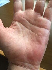 薬指の下に薄めですがv字ようなものがあります これは太陽環なので Yahoo 知恵袋