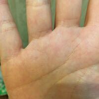 太陽環でしょうか 右手の薬指の爪に白い点ができたので ふと掌も Yahoo 知恵袋