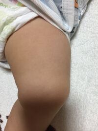 手足が細い赤ちゃん 体重が増えていてもミルクを足すべき こんにちは 2 Yahoo 知恵袋