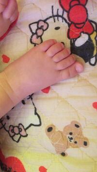 9ヶ月の息子 足の指が長いんですが何かの病気とかじゃないですか ただ単に Yahoo 知恵袋