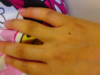 手にあるホクロなんですが 女性の右手の小指と薬指の関節の間に ホクロ Yahoo 知恵袋