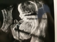 28歳 妊娠週4日の妊婦です 今日 産婦人科へ健診へ行き 先生か Yahoo 知恵袋