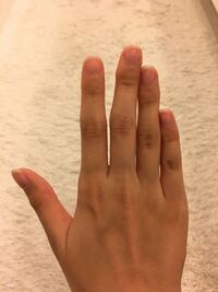 指ポキがかなり癖になってしまい やめられず何年も続けています 前の方が Yahoo 知恵袋