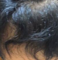 くせ毛についてです 僕は今 中学2年です 小学生の時は ものすごい Yahoo 知恵袋