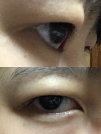腫れぼったい目の解消法 画像あり 私は腫れぼったい目がコンプ Yahoo 知恵袋
