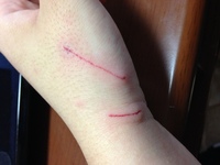 野良猫に引っかかれた傷の処置の方法を教えてください たった今猫に引っかかれまし Yahoo 知恵袋