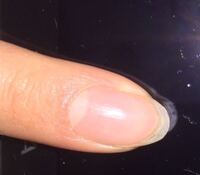 爪の半月 白い部分 が見えないので 爪の下の皮膚 甘皮 ってい Yahoo 知恵袋