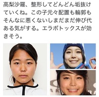 高梨沙羅さんって整形じゃなくて化粧ですよね みんなあんなに変わるものなんですか Yahoo 知恵袋