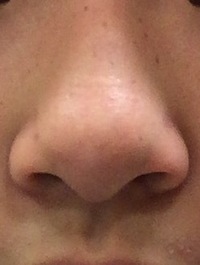 シンクロ選手はみんな鼻が高いけど あれは鼻栓してるからだと思うんですけ Yahoo 知恵袋