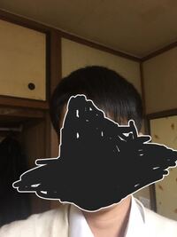 頭のハチ張りを治す方法を教えてください 私はよく小顔といわれます で Yahoo 知恵袋