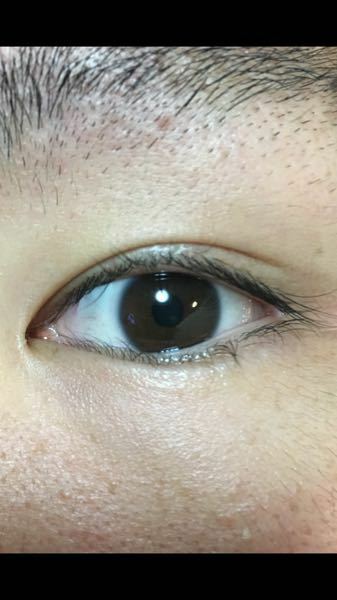 目の色を薄くする方法を教えてください 黒なので茶色っぽく透明感のある瞳に Yahoo 知恵袋