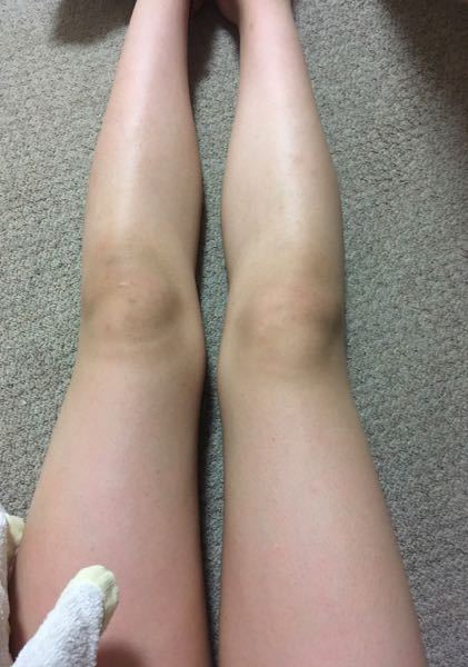 私はこの画像を見ればわかると思うのですが太ももが太すぎるのがコンプレックスです Yahoo 知恵袋