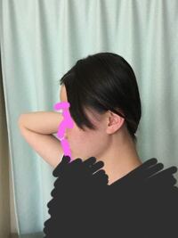 頭の形で悩んでいます 絶壁 のような感じで頭が大きく後ろ姿 Yahoo 知恵袋