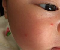赤ちゃんの顔の赤い点について 生後1ヶ月の子供の顔に突然赤 Yahoo 知恵袋