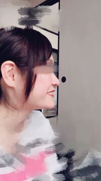 ｅラインありますか これってただのしゃくれなんですかね Yahoo 知恵袋