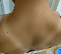 この日焼け跡 男子は幻滅しますか 水泳部の練習に日焼け止めを Yahoo 知恵袋