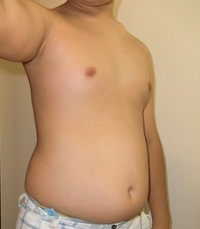 お腹の張りについてです 最近急に太ったような気がして特にご飯を食べた後 Yahoo 知恵袋