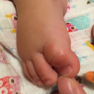 赤ちゃん 足の親指の甲にタコ 生後5ヶ月の女の子を育てています 既に寝返りが完 Yahoo 知恵袋 赤ちゃん 足の親指の甲にタコ 生後5ヶ月の女の子を育てています 既に寝返りが完 Yahoo 知恵袋