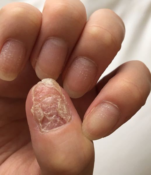 ネイルケア 解決済みの質問 Yahoo 知恵袋